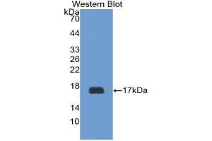 Western Blotting (WB) image for anti-Glycoprotein Ib (Platelet), beta Polypeptide (GP1BB) (AA 53-176) antibody (ABIN1868212) (GP1BB Antikörper  (AA 53-176))