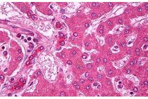 Anti-ABCA1 antibody IHC staining of human liver.