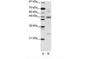 Image no. 2 for anti-NF-kappa-B inhibitor beta (NFKBIB) (AA 282-331) antibody (ABIN203071) (NFKBIB Antikörper  (AA 282-331))