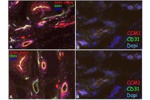 Immunofluorescence staining of Human foreskin (Cryo-section of unfixed tissue) with anti-CCM1 Antibody Cat.