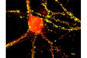 anti-Leucine Rich Repeat Containing 7 (LRRC7) (AA 877-891) antibody