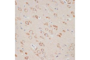 Immunohistochemistry of paraffin-embedded rat brain using  antibody (ABIN6129209, ABIN6137382, ABIN6137383 and ABIN6219595) at dilution of 1:100 (40x lens). (AXIN2 Antikörper  (AA 650-750))