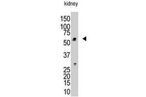 The RBCK1 polyclonal antibody  is used in Western blot to detect RBCK1 in mouse kidney tissue lysate. (RBCK1 Antikörper  (N-Term))