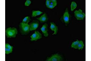 Immunofluorescent analysis of MCF-7 cells using ABIN7149603 at dilution of 1:100 and Alexa Fluor 488-congugated AffiniPure Goat Anti-Rabbit IgG(H+L) (DOCK8 Antikörper  (AA 1900-2099))