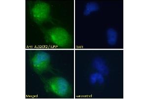 ABIN184938 Immunofluorescence analysis of paraformaldehyde fixed U251 cells, permeabilized with 0. (STRADB Antikörper  (C-Term))