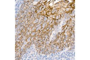 Immunohistochemistry of paraffin-embedded Human tonsil using TROP-2 antibody (ABIN7271103) at dilution of 1:2700 (40x lens). (TACSTD2 Antikörper)