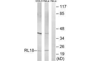 Western blot analysis of extracts from COLO cells and HeLa cells, using RPL18 antibody. (RPL18 Antikörper  (Internal Region))