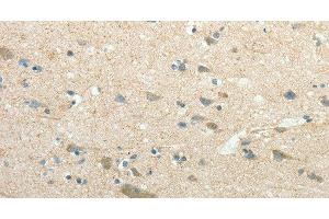 Immunohistochemistry of paraffin-embedded Human brain using SIRT3 Polyclonal Antibody at dilution of 1:30 (SIRT3 Antikörper)