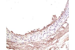 Formalin-fixed and paraffin-embedded rat Carotid artery labeled with Rabbit Anti-IGF-I Polyclonal Antibody , Unconjugated at 1:200 followed by conjugation to the secondary antibody and DAB staining (IGF1 Antikörper  (AA 49-100))