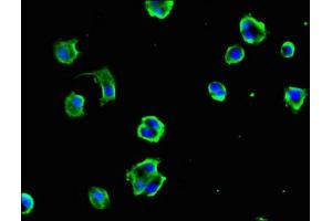 Immunofluorescent analysis of MCF-7 cells using ABIN7149312 at dilution of 1:100 and Alexa Fluor 488-congugated AffiniPure Goat Anti-Rabbit IgG(H+L) (DYNC1H1 Antikörper  (AA 12-66))