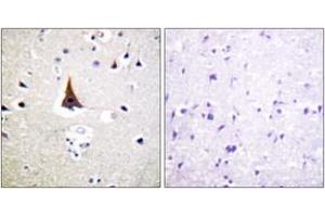 Immunohistochemistry analysis of paraffin-embedded human brain tissue, using VAV2 (Ab-142) Antibody.