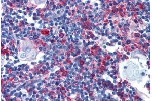 Human Thymus (formalin-fixed, paraffin-embedded) stained with CD74 antibody ABIN241561 at 10 µg/ml followed by biotinylated anti-mouse IgG secondary antibody ABIN481714, alkaline phosphatase-streptavidin and chromogen.