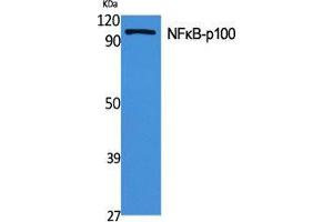 Western Blot (WB) analysis of specific cells using NFkappaB-p100 Polyclonal Antibody. (NFKB2 Antikörper  (Thr160))