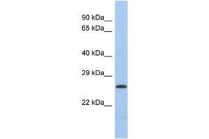 Western Blotting (WB) image for anti-Polymerase (DNA Directed), lambda (POLL) (Middle Region) antibody (ABIN2785954) (POLL Antikörper  (Middle Region))