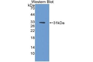 Western blot analysis of the recombinant protein. (DCT Antikörper  (AA 28-263))