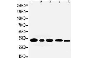 Anti-Aquaporin 3 antibody, Western blotting Lane 1: Rat Kidney Tissue Lysate Lane 2: Rat Lung Tissue Lysate Lane 3: Mouse Kidney Tissue Lysate Lane 4: M453 Cell Lysate Lane 5: MMC Cell Lysate (AQP3 Antikörper  (C-Term))