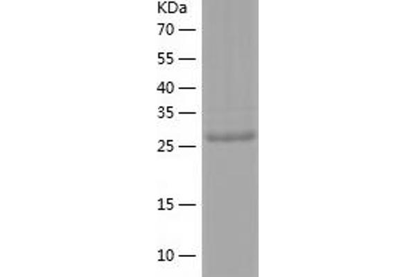 Caspase 1 Protein (CASP1) (AA 120-404) (His tag)