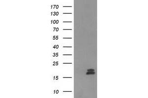 Western Blotting (WB) image for anti-Chromosome 2 Open Reading Frame 40 (C2orf40) antibody (ABIN1497049) (C2orf40 Antikörper)