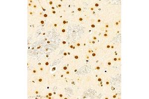 Immunohistochemistry (Paraffin-embedded Sections) (IHC (p)) image for anti-RNA Binding Motif Protein 45 (RBM45) antibody (ABIN7075477)