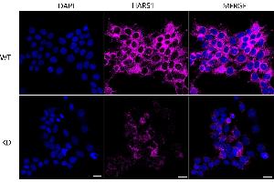 Immunocytochemical staining of HeLa cells using HARS1 antibody (ABIN7798918), 1:1,000), Top panel: wild-type (WT), Bottom panal: HARS1 shRNA knockdown (KD). (Histidine--tRNA Ligase (HARS-1) Antikörper)