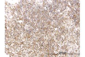 Immunoperoxidase of monoclonal antibody to STAT5B on formalin-fixed paraffin-embedded human lymph node. (STAT5B Antikörper  (AA 678-787))
