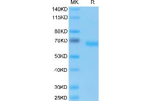 SDS-PAGE (SDS) image for Epithelial Cell Adhesion Molecule (EPCAM) (AA 24-265) protein (Fc Tag) (ABIN7274026)