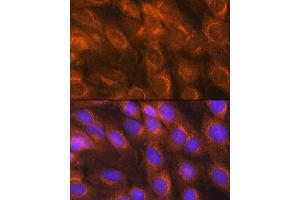 Immunofluorescence analysis of C6 cells using LM Rabbit pAb (ABIN6131613, ABIN6143266, ABIN6143267 and ABIN6214694) at dilution of 1:100 (40x lens). (LMAN1 Antikörper  (AA 270-480))