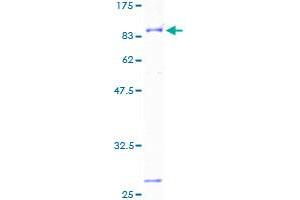 BTD Protein (AA 1-543) (GST tag)