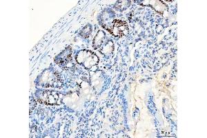IHC analysis of PCNA using anti-PCNA antibody (ABIN7599179).