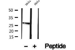 Western blot analysis of extracts of HeLa cells, using RAB12 antibody. (RAB12 Antikörper  (C-Term))
