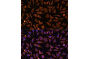 Immunofluorescence analysis of L929 cells using RA antibody (ABIN7269797) at dilution of 1:100. (RAB1A Antikörper  (AA 1-100))
