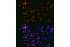 Immunofluorescence analysis of Jurkat cells using TLR6 Rabbit pAb (ABIN7270847) at dilution of 1:150 (40x lens).