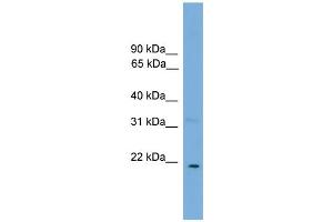 WB Suggested Anti-CTF1 Antibody Titration: 0. (Cardiotrophin 1 Antikörper  (N-Term))