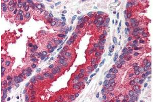 Human Prostate (formalin-fixed, paraffin-embedded) stained with EIF2AK2 antibody ABIN214488 at 2. (EIF2AK2 Antikörper  (C-Term))