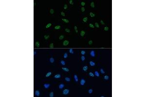 Immunofluorescence analysis of U-2 OS cells using MKL1 Polyclonal Antibody (ABIN6132380, ABIN6143855, ABIN6143858 and ABIN6224589) at dilution of 1:100 (40x lens).