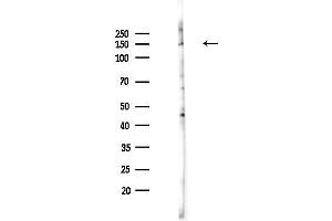 anti-B-Cell CLL/lymphoma 9 (BCL9) (C-Term) antibody