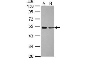 WB Image Sample (30 ug of whole cell lysate) A: A431 B: Jurkat 10% SDS PAGE antibody diluted at 1:1000 (TAF7 Antikörper  (Center))