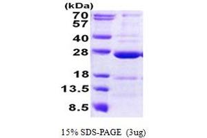 SDS-PAGE (SDS) image for Coiled-Coil Domain Containing 90B (CCDC90B) (AA 43-230) protein (His tag) (ABIN6387200)