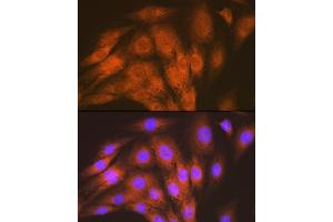 Immunofluorescence analysis of C6 cells using  Rabbit mAb (ABIN7265412) at dilution of 1:100 (40x lens). (ACVRL1 Antikörper)