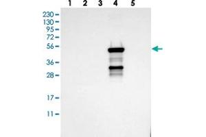 Western blot analysis of Lane 1: RT-4, Lane 2: U-251 MG, Lane 3: Human Plasma, Lane 4: Liver, Lane 5: Tonsil with CYP2C19 polyclonal antibody . (CYP2C9 Antikörper)