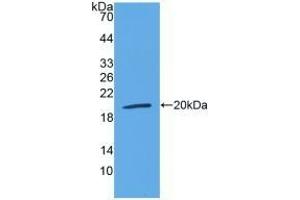 Western Blotting (WB) image for anti-Lymphotoxin beta Receptor (TNFR Superfamily, Member 3) (LTBR) (AA 66-215) antibody (ABIN7437122)