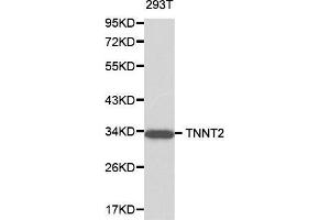 Western blot analysis of 293T cell lysate using TNNT2 antibody. (Cardiac Troponin T2 Antikörper  (AA 1-120))