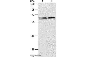 Western blot analysis of 293T and Jurkat cell, using ALAS2 Polyclonal Antibody at dilution of 1:1000
