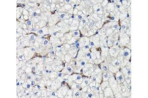 Immunohistochemistry of paraffin-embedded Human liver using COMP Polyclonal Antibody at dilution of 1:100 (40x lens). (COMP Antikörper)