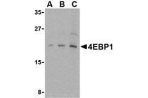 Western blot analysis of AP30001PU-N 4E-BP1 antibody in 3T3 cell lysate with 4E-BP1 antibody at (A) 2. (eIF4EBP1 Antikörper  (C-Term))