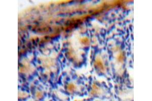 Used in DAB staining on fromalin fixed paraffin-embedded Bowels tissue (VEGFC Antikörper  (AA 47-413))