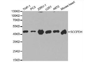 Western blot analysis of extracts of various cell lines, using SCCPDH antibody. (SCCPDH Antikörper  (AA 1-270))