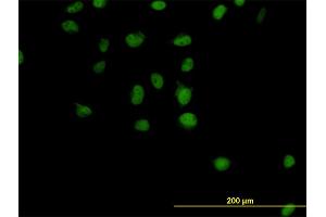Immunofluorescence of monoclonal antibody to CSE1L on HeLa cell. (Exportin 2 Antikörper  (AA 872-971))