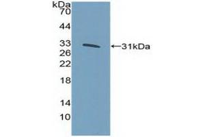 Detection of Recombinant KLF5, Human using Polyclonal Antibody to Kruppel Like Factor 5, Intestinal (KLF5) (KLF5 Antikörper  (AA 216-457))