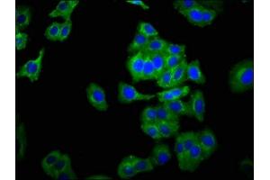 Immunofluorescence staining of HepG2 cells with ABIN7161195 at 1:266, counter-stained with DAPI. (NCAM2 Antikörper  (AA 209-333))